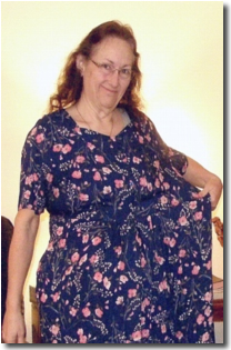 Barbara After Gastric Bypass Surgery