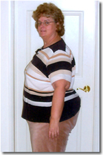before gastric bypass surgery